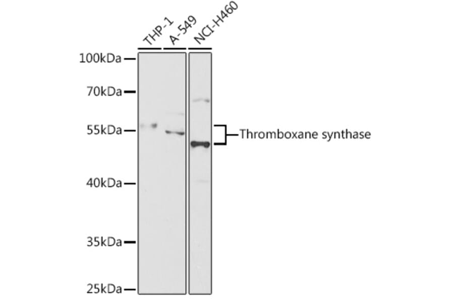 Western Blot - Anti-Thromboxane synthase Antibody (A87578) - Antibodies.com