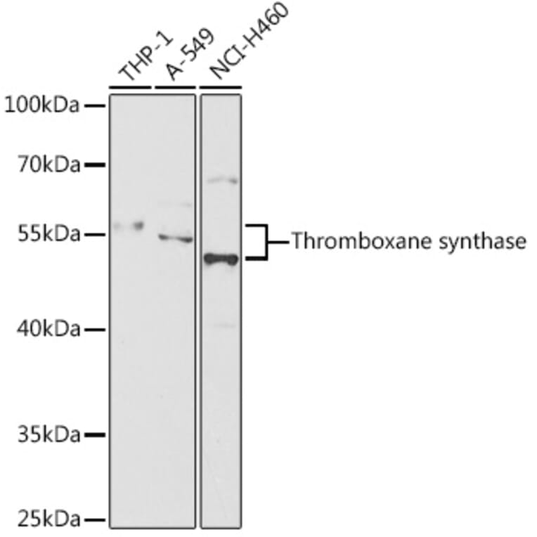 Western Blot - Anti-Thromboxane synthase Antibody (A87578) - Antibodies.com