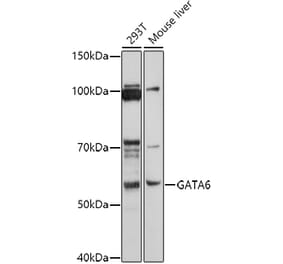 Western Blot - Anti-Gata6 Antibody (A87579) - Antibodies.com