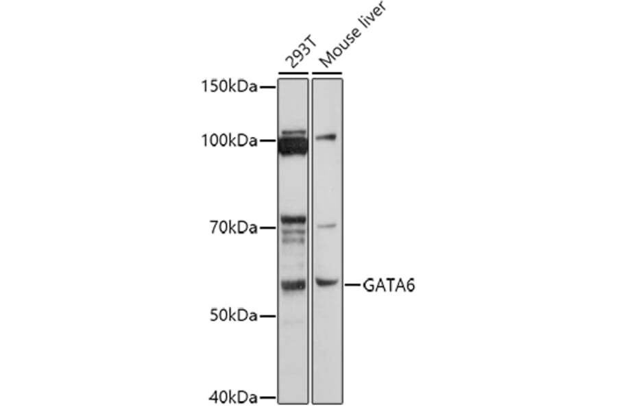 Western Blot - Anti-Gata6 Antibody (A87579) - Antibodies.com
