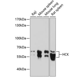 Western Blot - Anti-Hck Antibody (A87580) - Antibodies.com