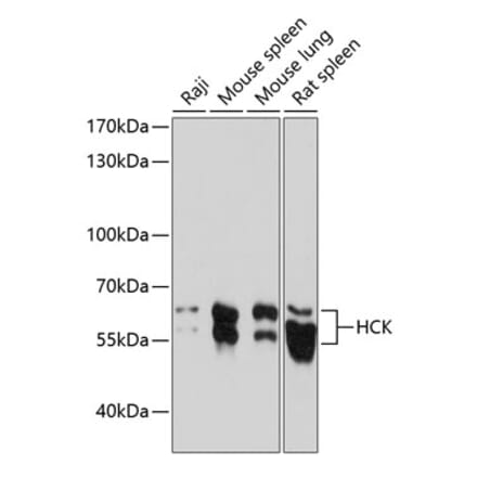 Western Blot - Anti-Hck Antibody (A87580) - Antibodies.com