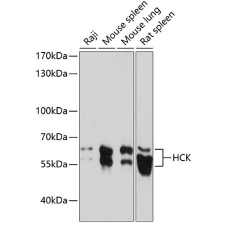 Western Blot - Anti-Hck Antibody (A87580) - Antibodies.com