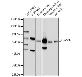 Western Blot - Anti-Asparagine synthetase Antibody (A87581) - Antibodies.com