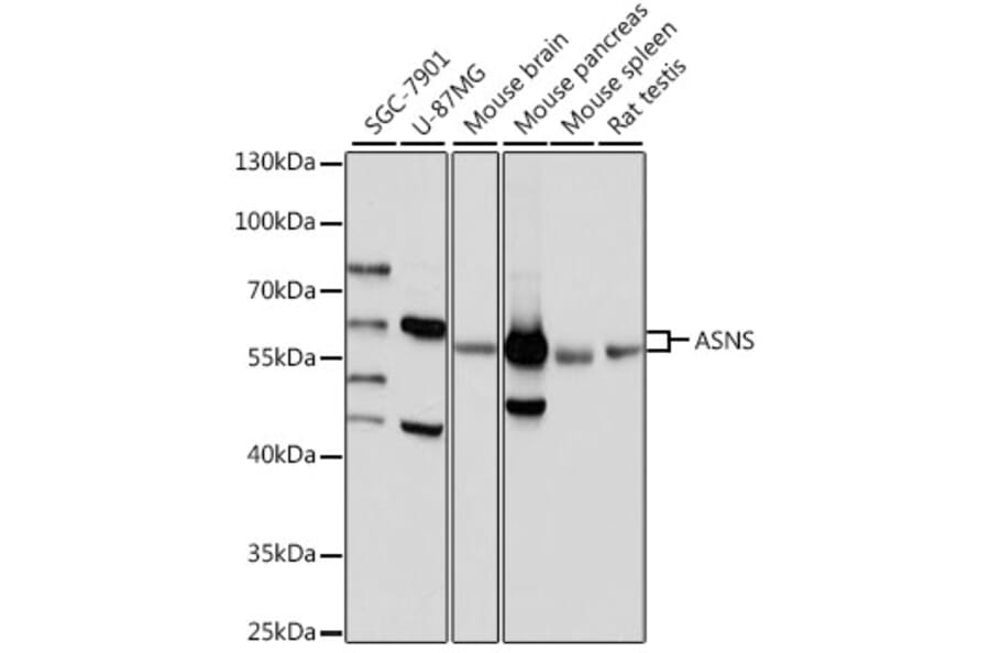 Western Blot - Anti-Asparagine synthetase Antibody (A87581) - Antibodies.com