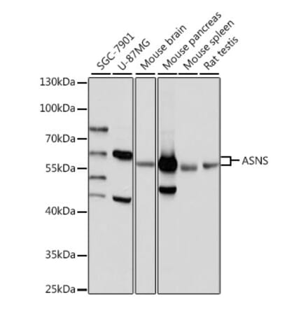 Western Blot - Anti-Asparagine synthetase Antibody (A87581) - Antibodies.com