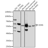 Western Blot - Anti-Asparagine synthetase Antibody (A87581) - Antibodies.com