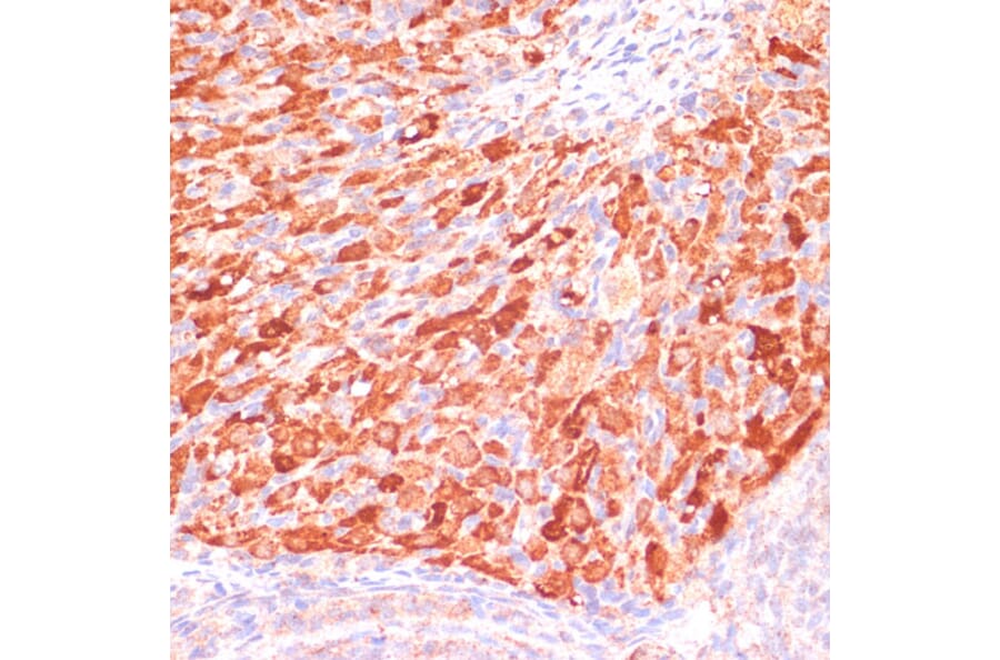 Immunohistochemistry - Anti-Asparagine synthetase Antibody (A87581) - Antibodies.com
