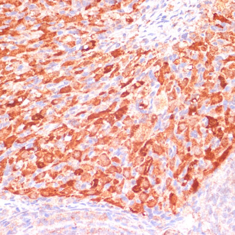 Immunohistochemistry - Anti-Asparagine synthetase Antibody (A87581) - Antibodies.com