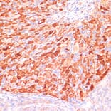 Immunohistochemistry - Anti-Asparagine synthetase Antibody (A87581) - Antibodies.com