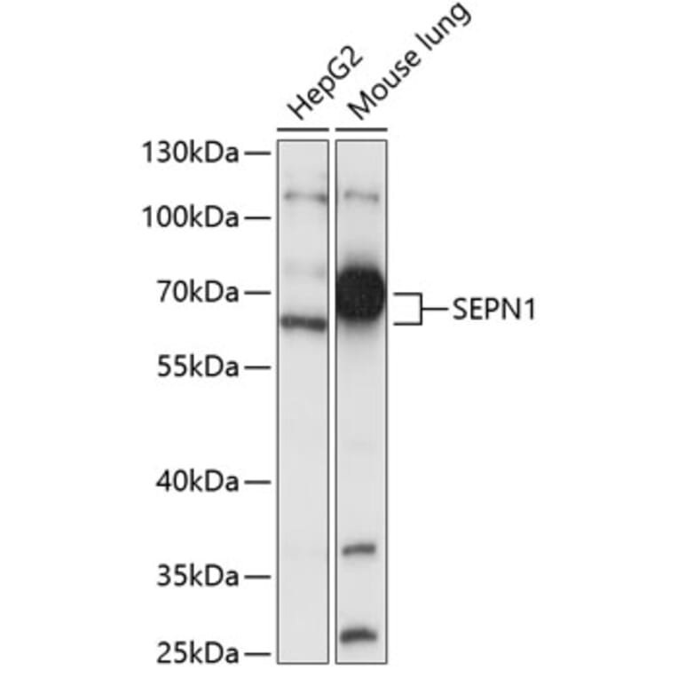 Western Blot - Anti-SEPN1/SELN Antibody (A87582) - Antibodies.com