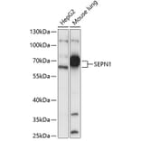 Western Blot - Anti-SEPN1/SELN Antibody (A87582) - Antibodies.com