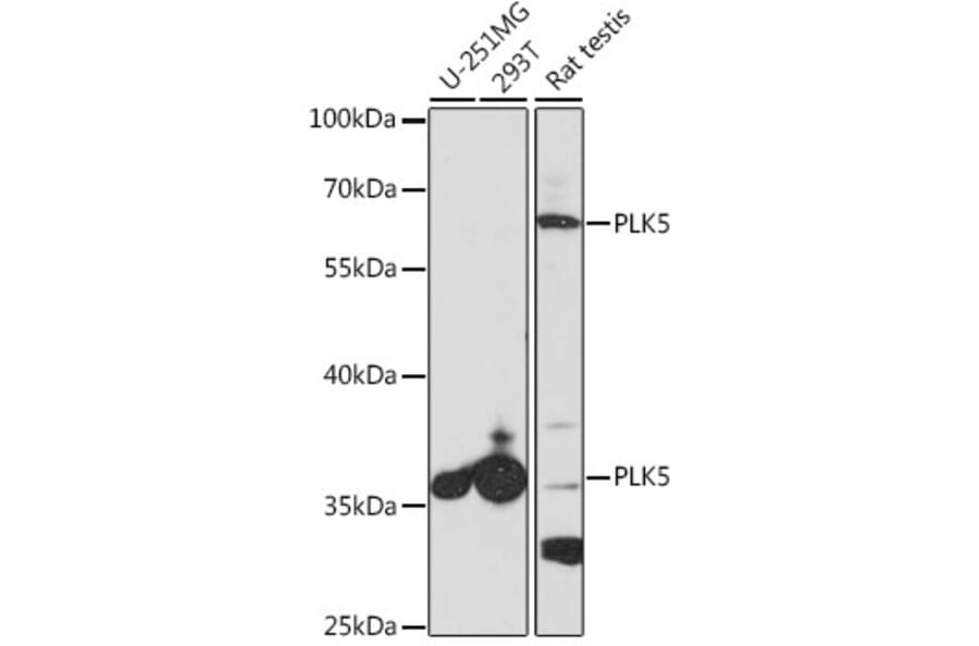 Western Blot - Anti-PLK5 Antibody (A14442) - Antibodies.com