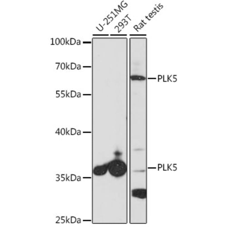 Western Blot - Anti-PLK5 Antibody (A14442) - Antibodies.com