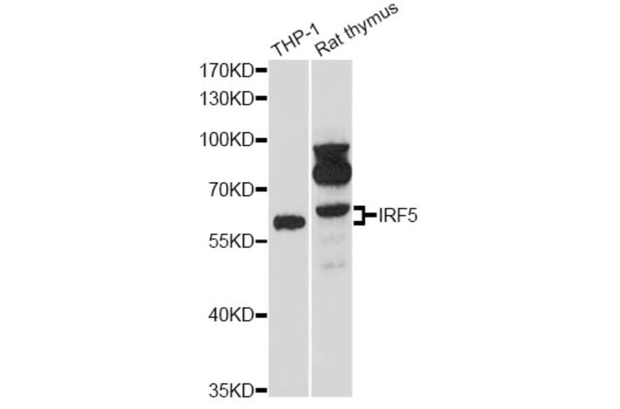 Western Blot - Anti-IRF5 Antibody (A13621) - Antibodies.com