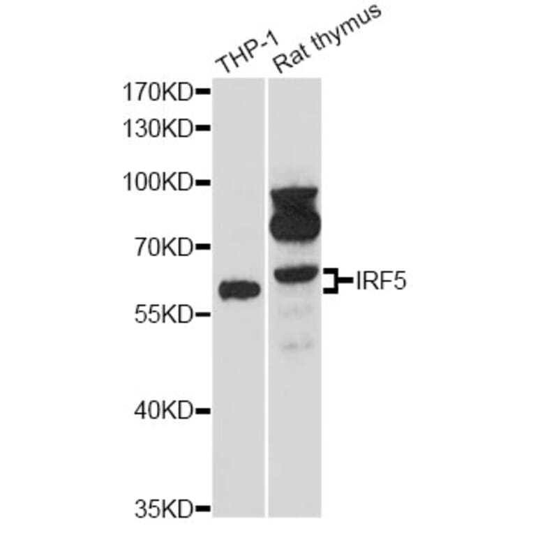 Western Blot - Anti-IRF5 Antibody (A13621) - Antibodies.com