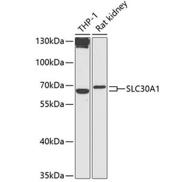 Western Blot - Anti-ZnT1 Antibody (A87585) - Antibodies.com
