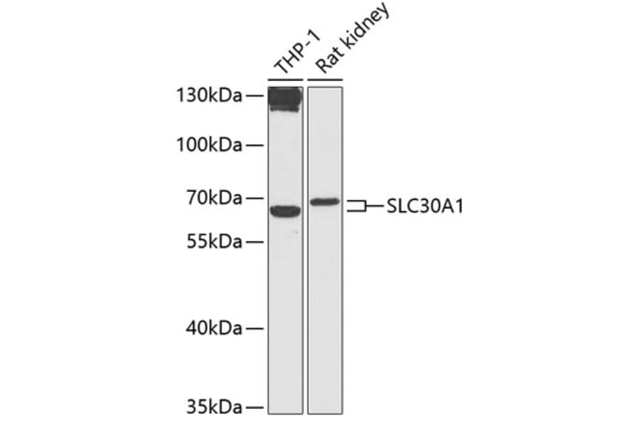 Western Blot - Anti-ZnT1 Antibody (A87585) - Antibodies.com