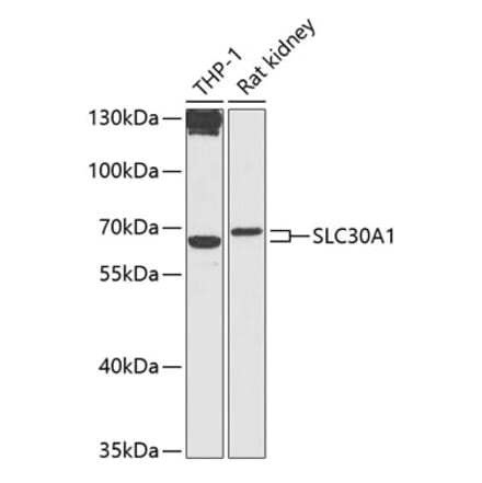 Western Blot - Anti-ZnT1 Antibody (A87585) - Antibodies.com