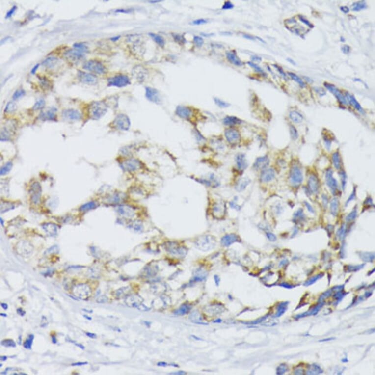 Immunohistochemistry - Anti-ZnT1 Antibody (A87585) - Antibodies.com