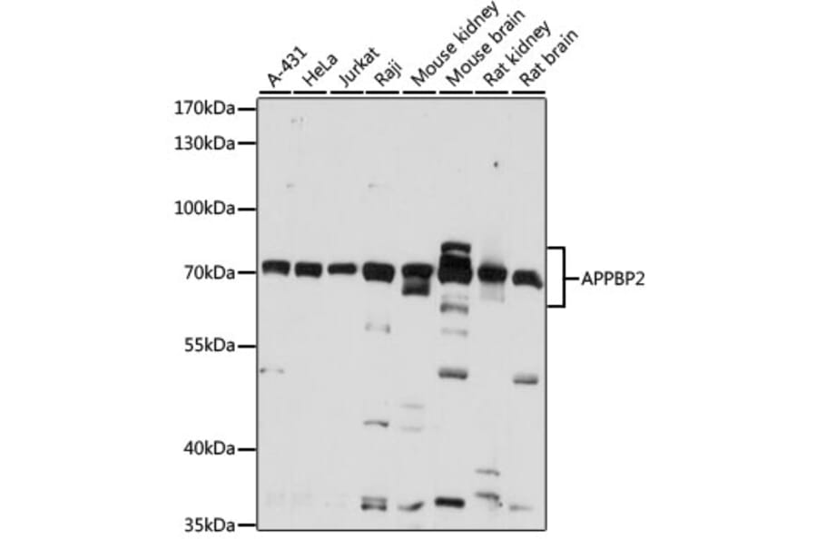 Western Blot - Anti-APPBP2 Antibody (A87586) - Antibodies.com