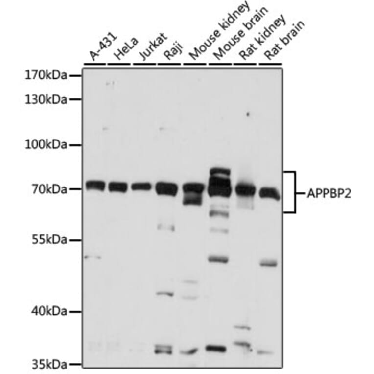 Western Blot - Anti-APPBP2 Antibody (A87586) - Antibodies.com