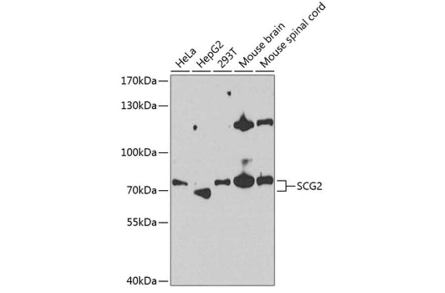 Western Blot - Anti-Chromogranin C / SGII Antibody (A87588) - Antibodies.com