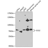 Western Blot - Anti-Chromogranin C / SGII Antibody (A87588) - Antibodies.com