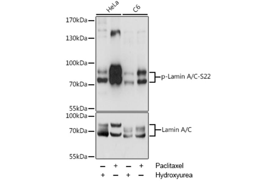 Western Blot - Anti-Lamin A (phospho Ser22) Antibody (A87589) - Antibodies.com