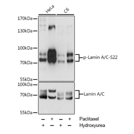 Western Blot - Anti-Lamin A (phospho Ser22) Antibody (A87589) - Antibodies.com