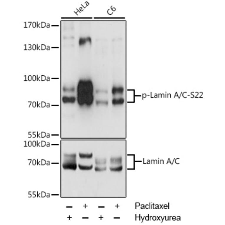 Western Blot - Anti-Lamin A (phospho Ser22) Antibody (A87589) - Antibodies.com
