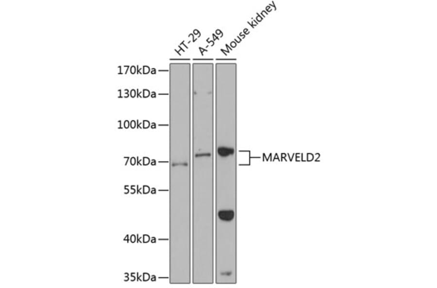 Western Blot - Anti-MARVELD2 Antibody (A87590) - Antibodies.com