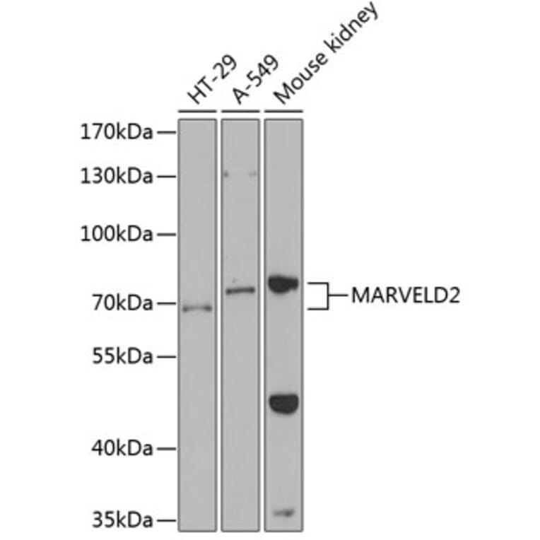 Western Blot - Anti-MARVELD2 Antibody (A87590) - Antibodies.com
