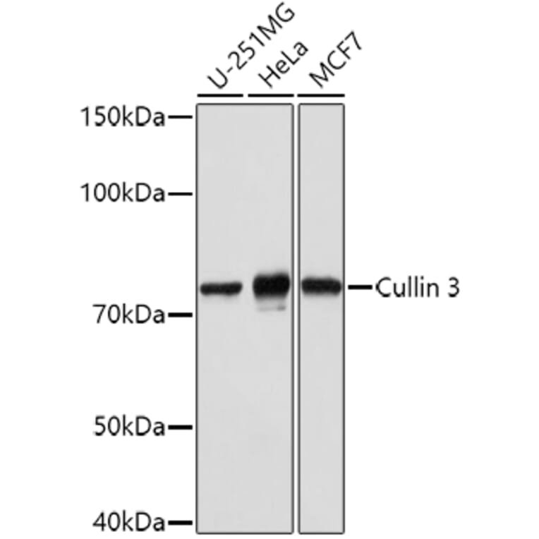 Western Blot - Anti-Cullin 3/CUL-3 Antibody (A87591) - Antibodies.com