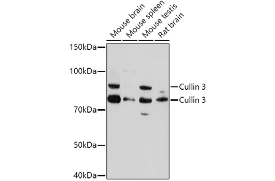 Western Blot - Anti-Cullin 3/CUL-3 Antibody (A87591) - Antibodies.com