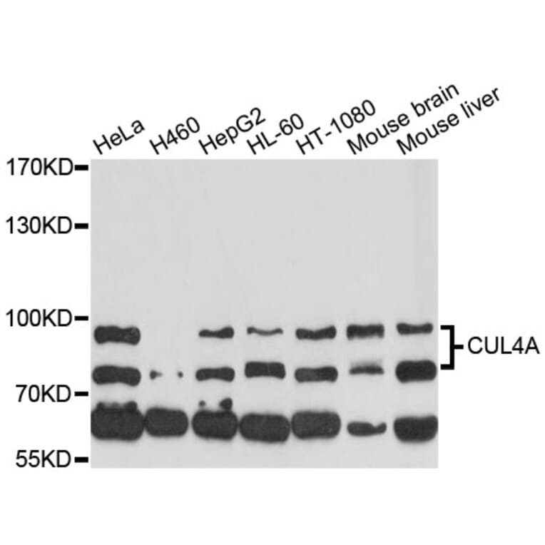 Western Blot - Anti-CUL4A Antibody (A13911) - Antibodies.com