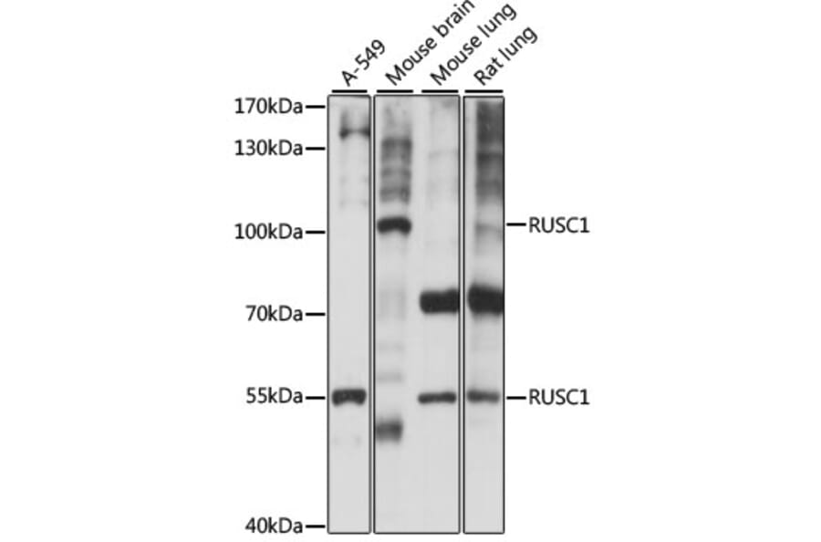 Western Blot - Anti-RUSC1 Antibody (A87594) - Antibodies.com