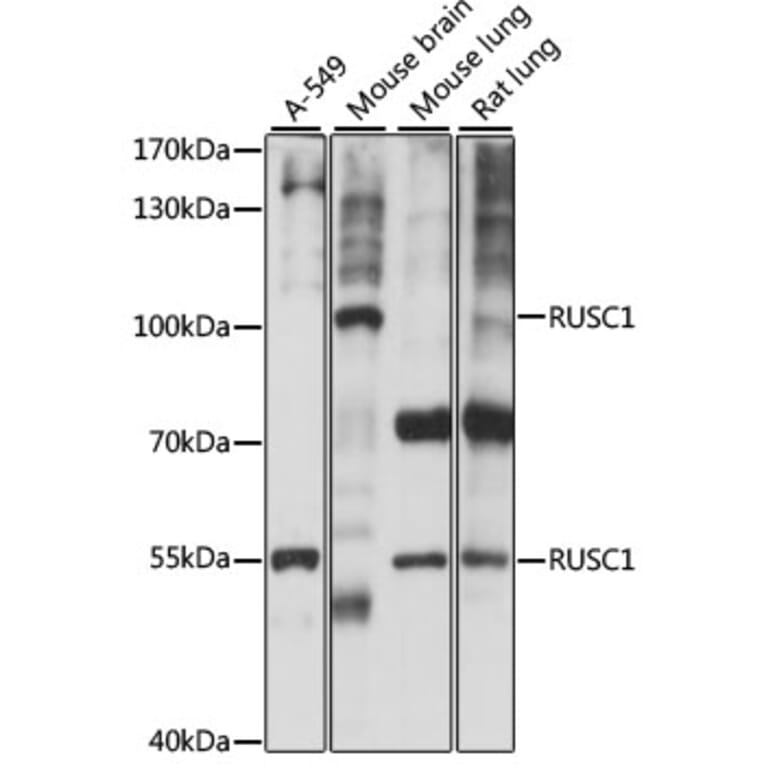 Western Blot - Anti-RUSC1 Antibody (A87594) - Antibodies.com