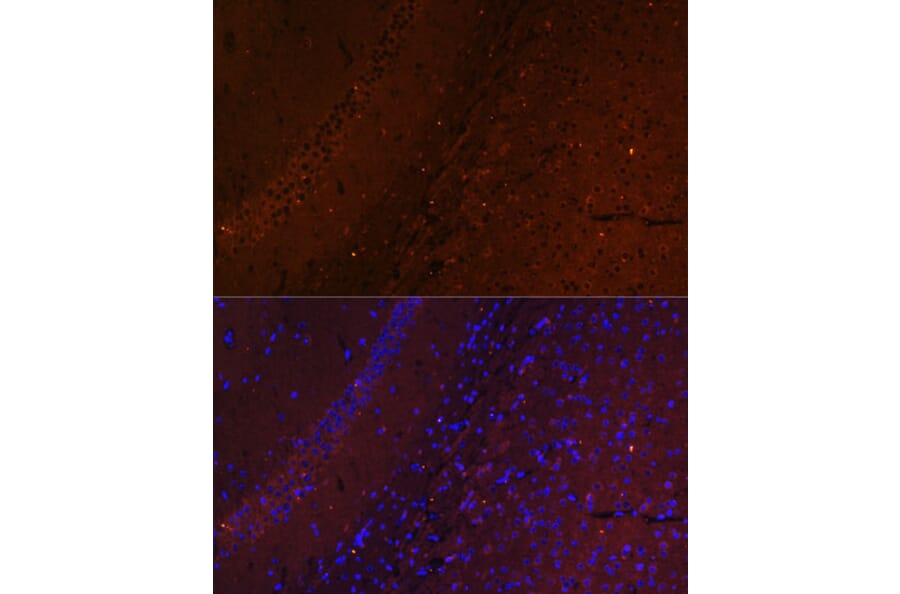 Immunofluorescence - Anti-RUSC1 Antibody (A87594) - Antibodies.com