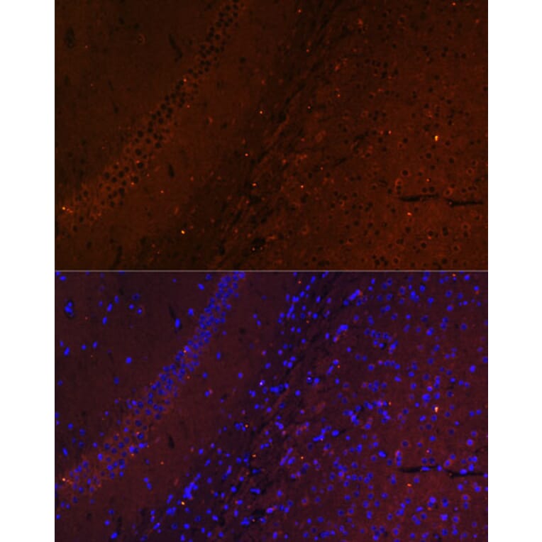 Immunofluorescence - Anti-RUSC1 Antibody (A87594) - Antibodies.com