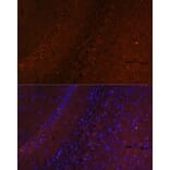 Immunofluorescence - Anti-RUSC1 Antibody (A87594) - Antibodies.com