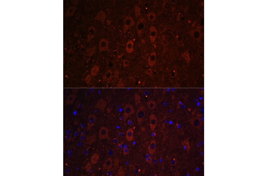 Immunofluorescence - Anti-RUSC1 Antibody (A87594) - Antibodies.com
