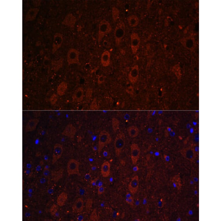 Immunofluorescence - Anti-RUSC1 Antibody (A87594) - Antibodies.com