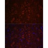 Immunofluorescence - Anti-RUSC1 Antibody (A87594) - Antibodies.com