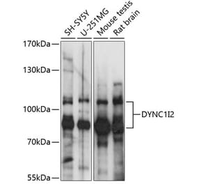 Western Blot - Anti-DYNC1I2 Antibody (A87595) - Antibodies.com