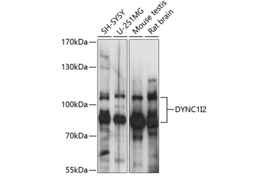 Western Blot - Anti-DYNC1I2 Antibody (A87595) - Antibodies.com
