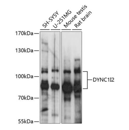 Western Blot - Anti-DYNC1I2 Antibody (A87595) - Antibodies.com