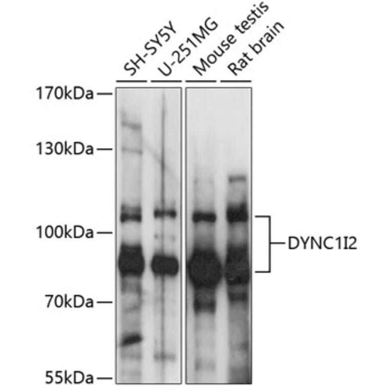 Western Blot - Anti-DYNC1I2 Antibody (A87595) - Antibodies.com