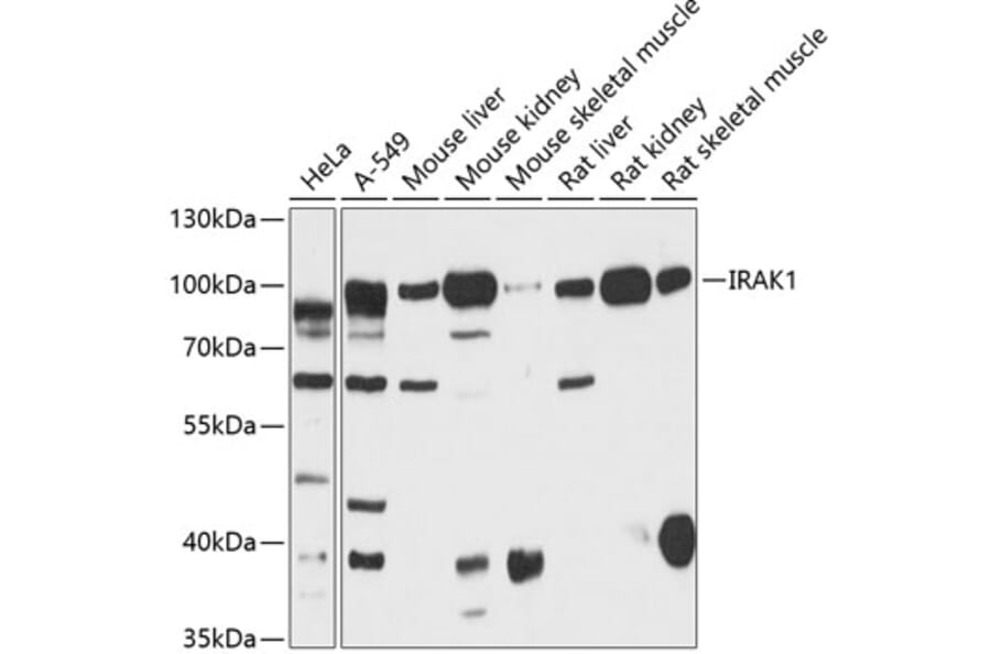 Western Blot - Anti-IRAK-1 Antibody (A87596) - Antibodies.com