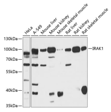 Western Blot - Anti-IRAK-1 Antibody (A87596) - Antibodies.com